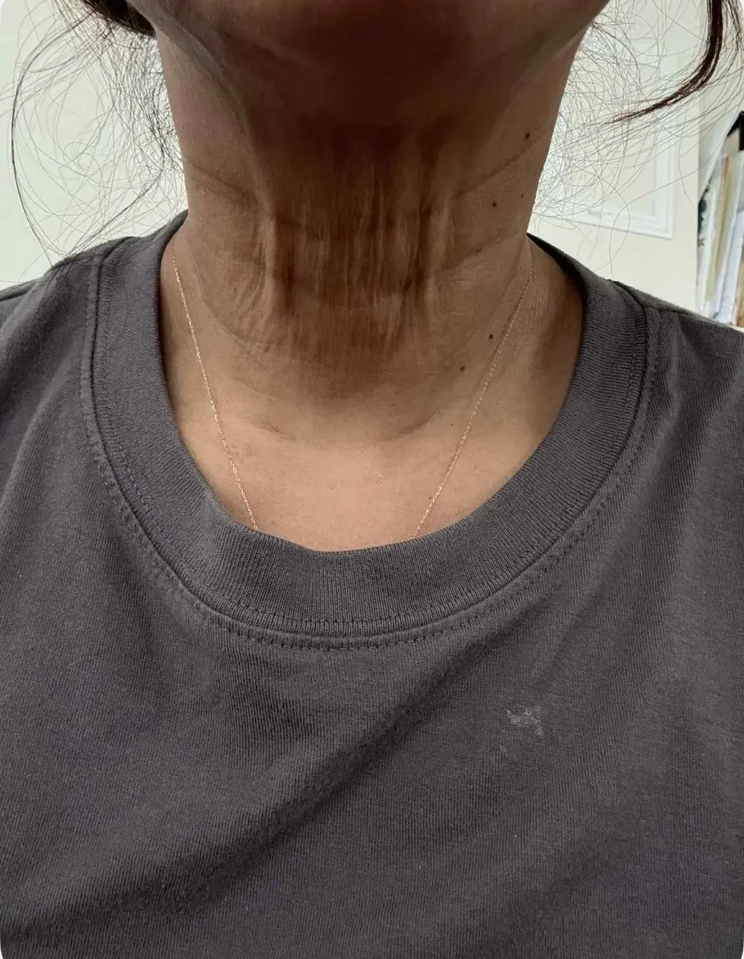 Woori Plastic Surgery Clinic — 1