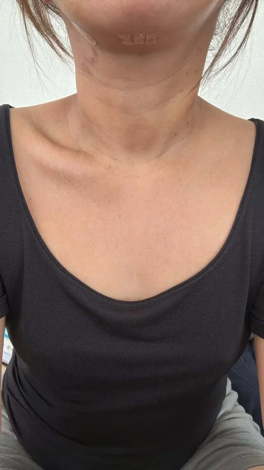 Woori Plastic Surgery Clinic — 2
