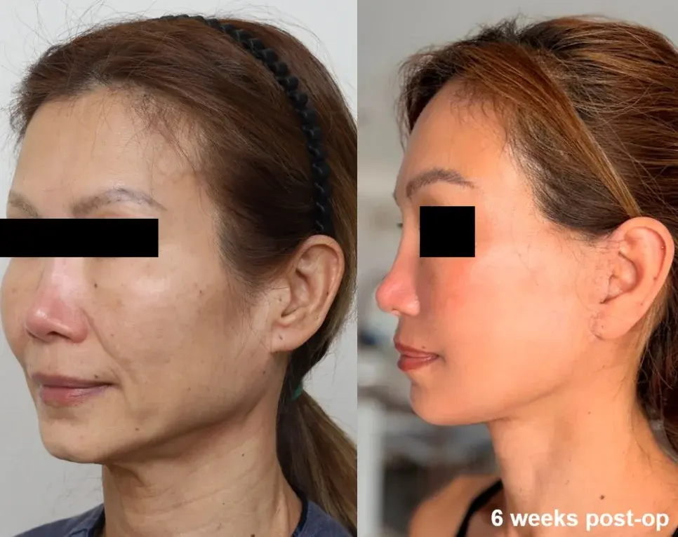 IPCHE Plastic Surgery — 1