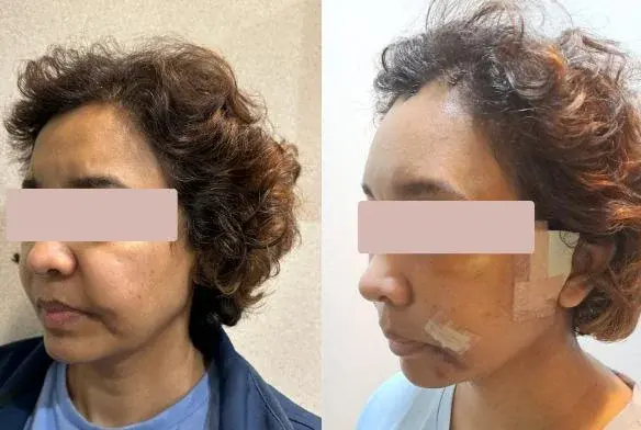 GIRIN Plastic Surgery Clinic — 1