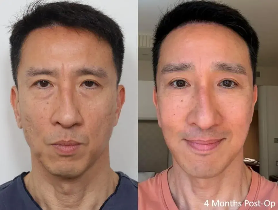 IPCHE Plastic Surgery — 1