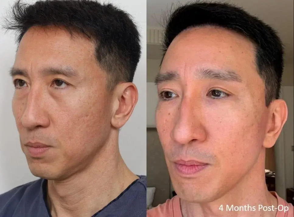 IPCHE Plastic Surgery — 2