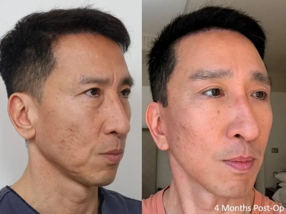 IPCHE Plastic Surgery — 3