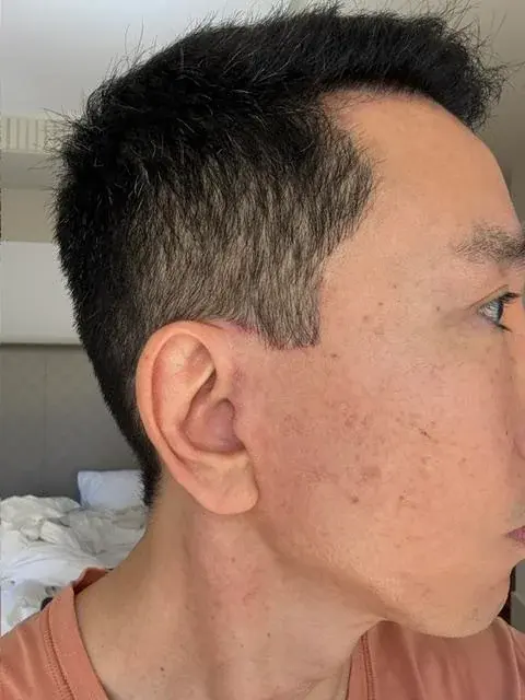 IPCHE Plastic Surgery — 4