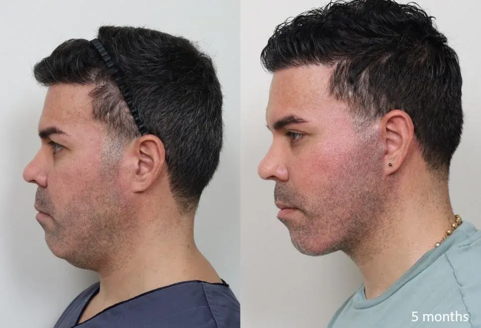 IPCHE Plastic Surgery — 1
