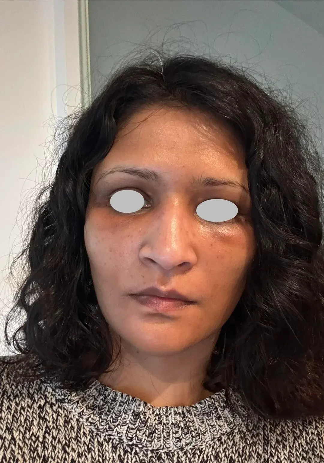 IPCHE Plastic Surgery — 1