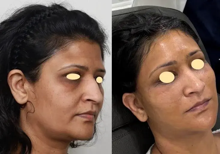 IPCHE Plastic Surgery — 1