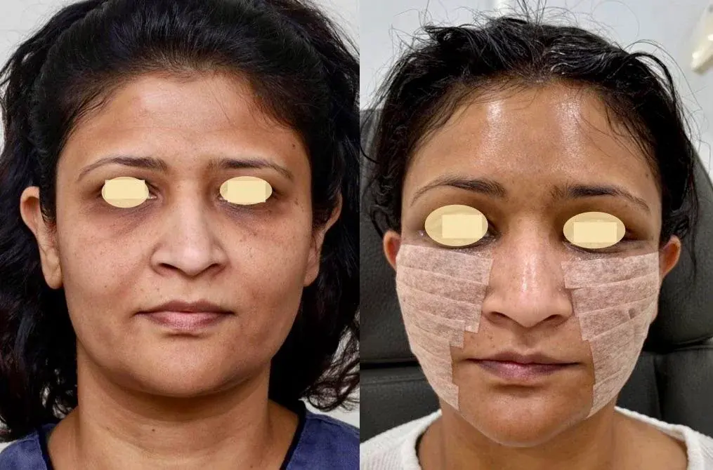 IPCHE Plastic Surgery — 2