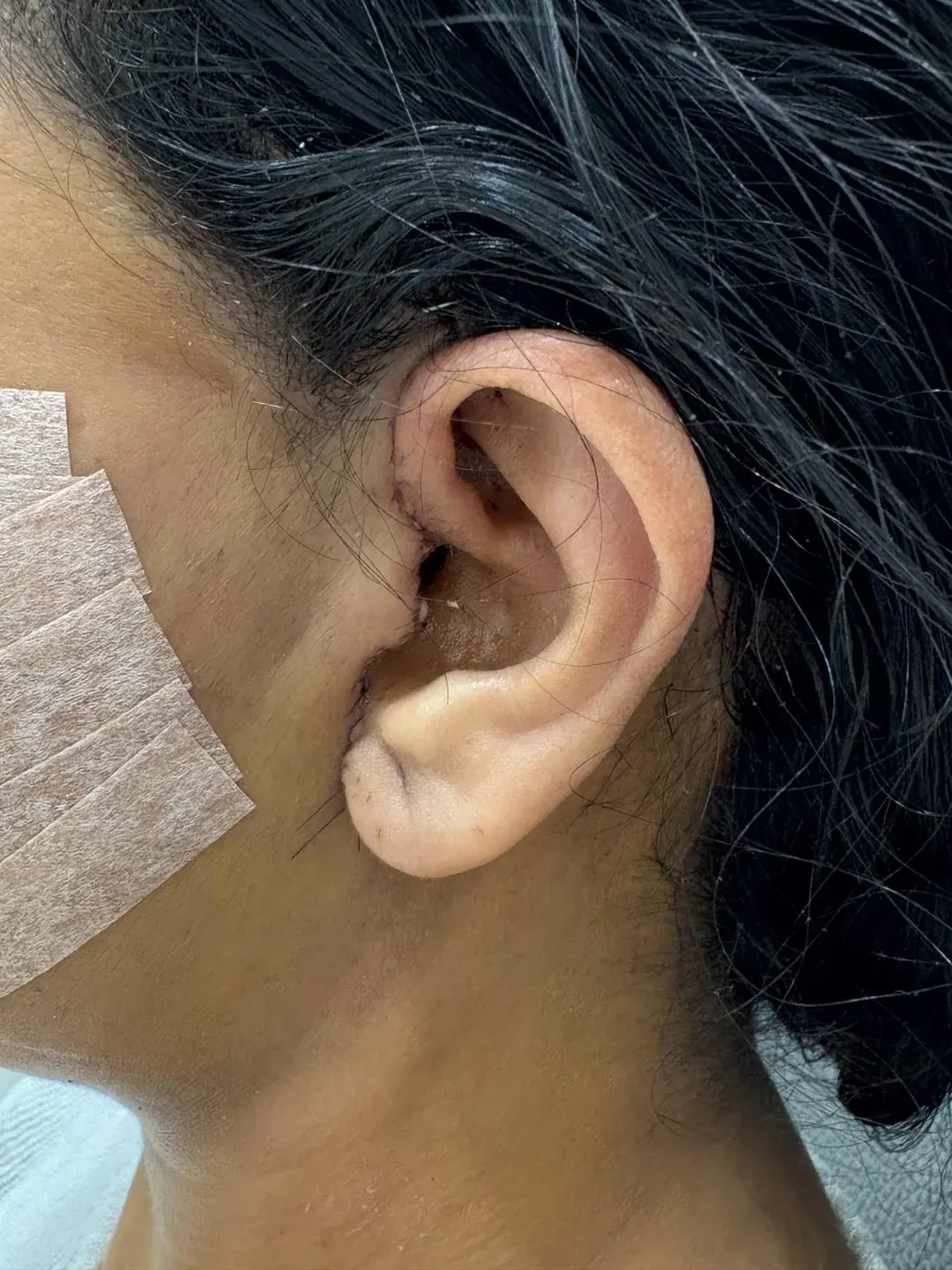 IPCHE Plastic Surgery — 3