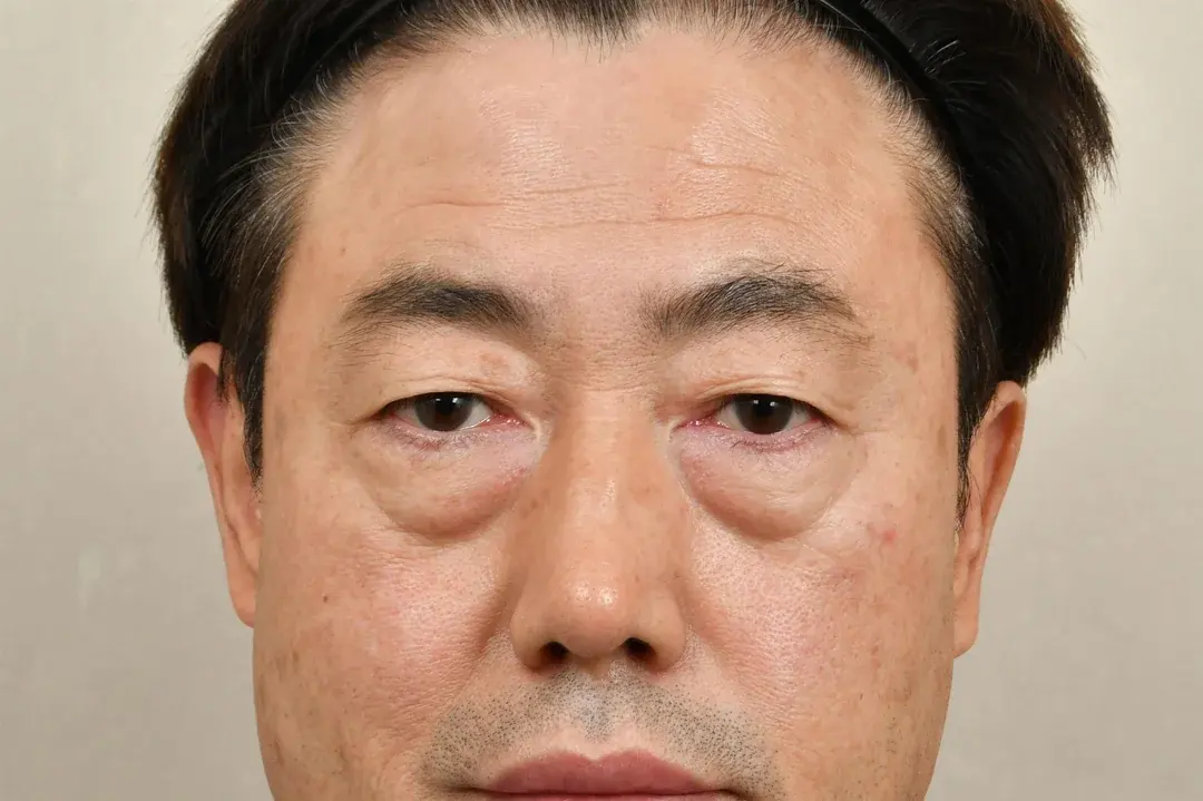 Apgujeong Seoul Plastic Surgery — 1