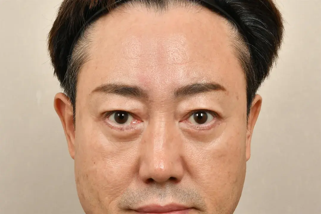 Apgujeong Seoul Plastic Surgery — 2