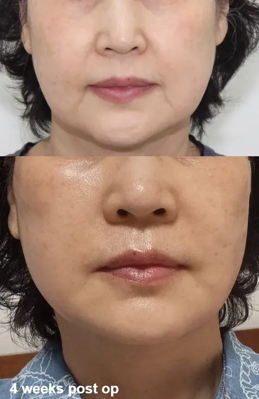 IPCHE Plastic Surgery — 1