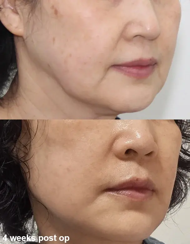 IPCHE Plastic Surgery — 2