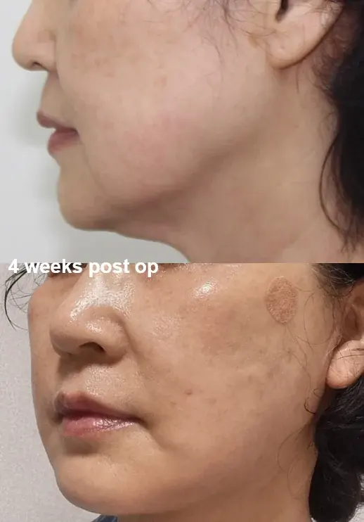 IPCHE Plastic Surgery — 3