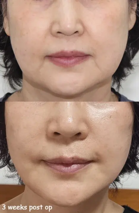 IPCHE Plastic Surgery — 1