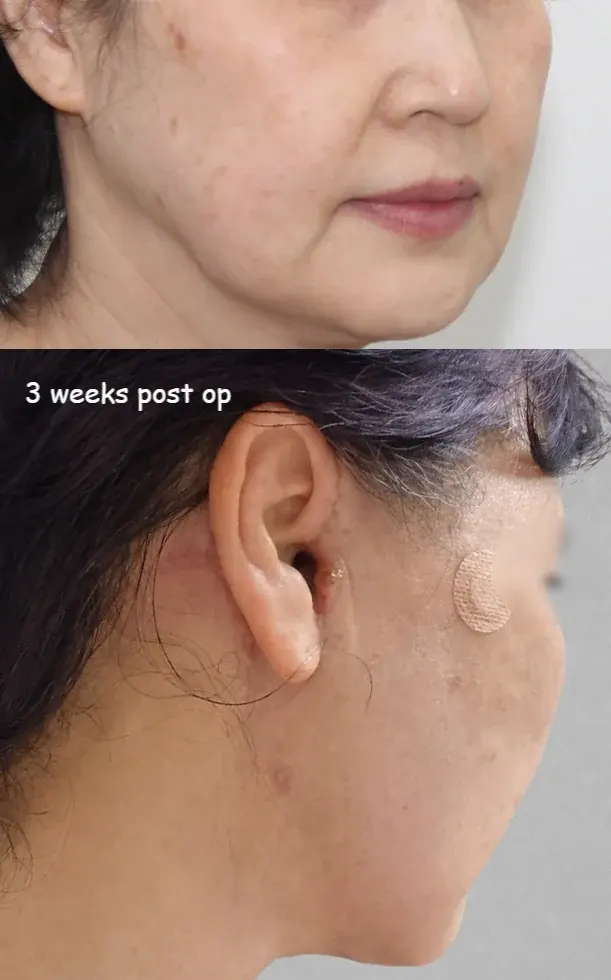 IPCHE Plastic Surgery — 2
