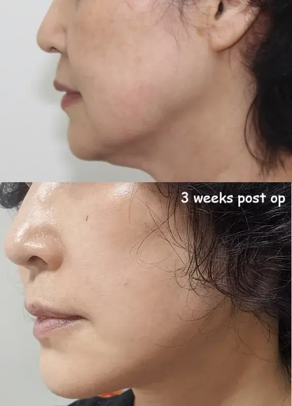 IPCHE Plastic Surgery — 3