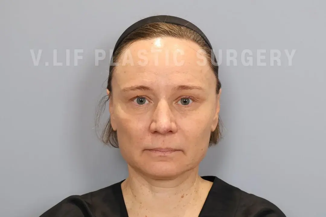 V.LIF Plastic Surgery — 1