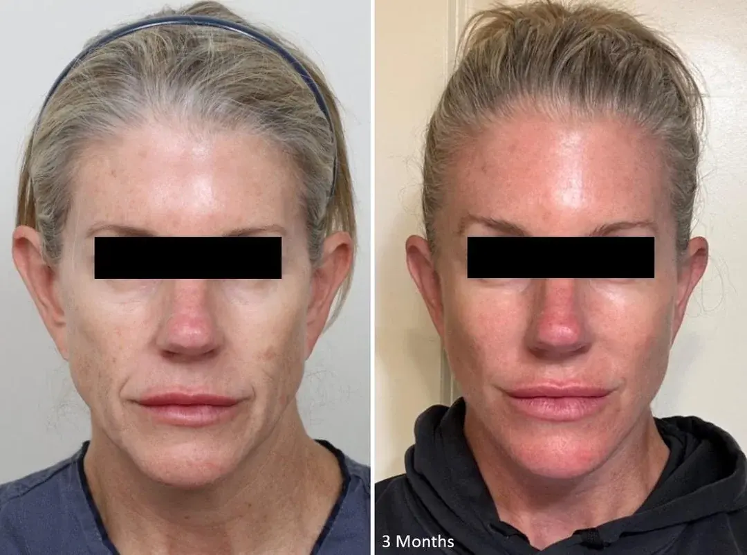 IPCHE Plastic Surgery — 1