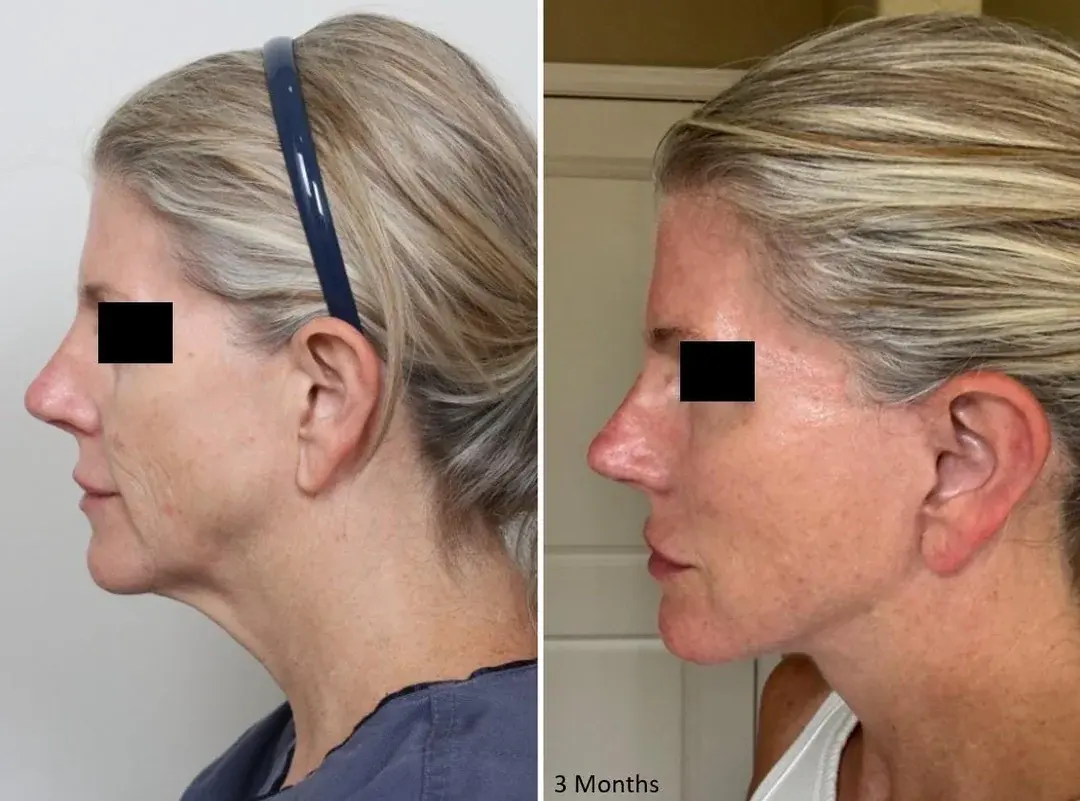 IPCHE Plastic Surgery — 2