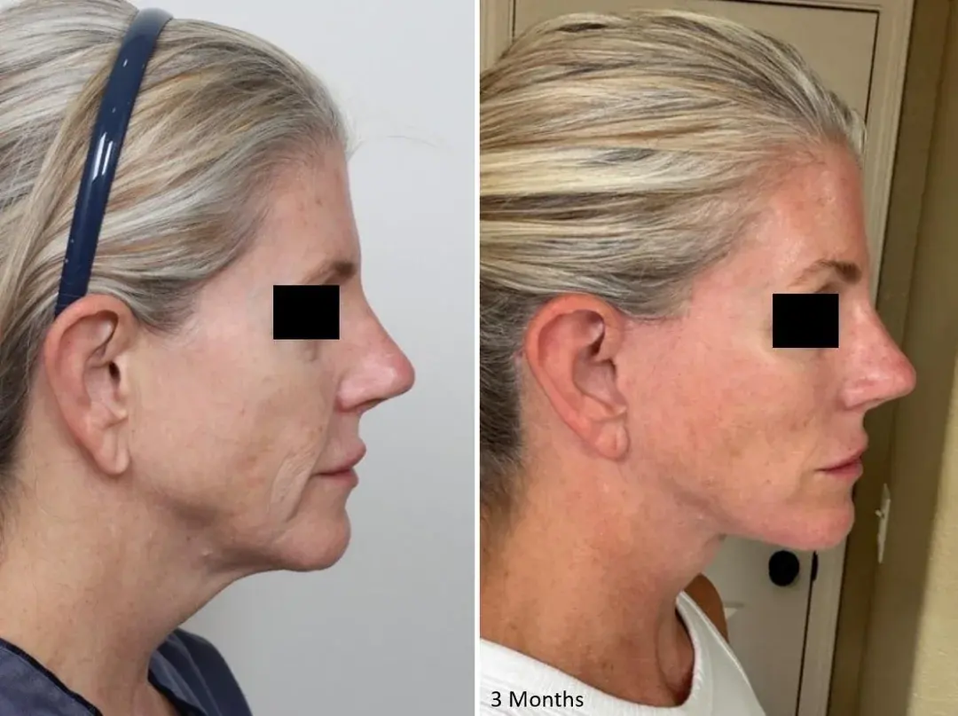IPCHE Plastic Surgery — 3