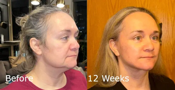 IPCHE Plastic Surgery — 1