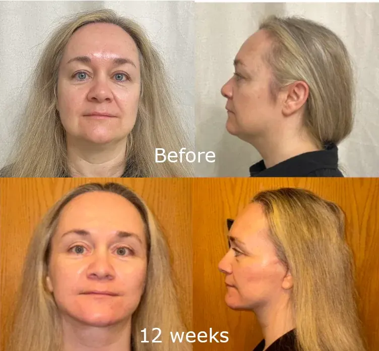 IPCHE Plastic Surgery — 2