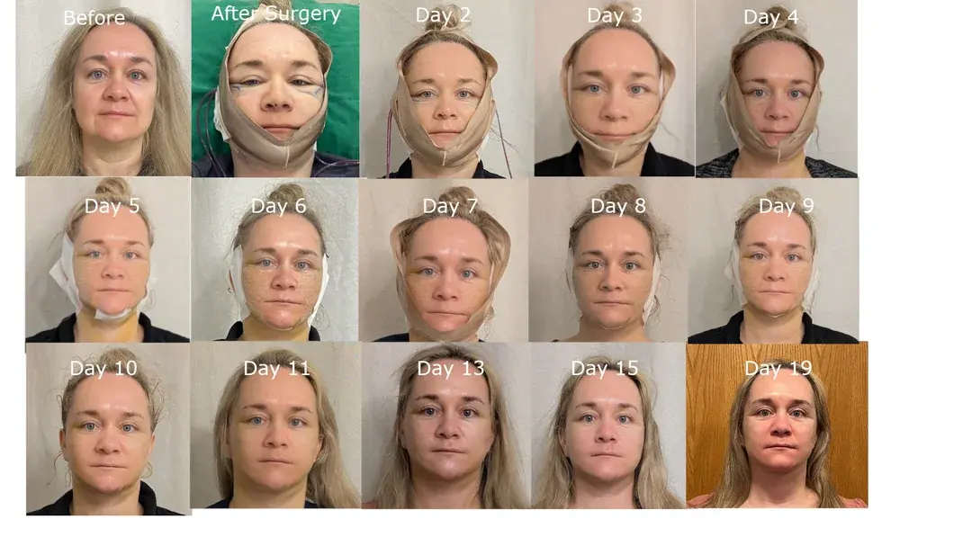 IPCHE Plastic Surgery — 3