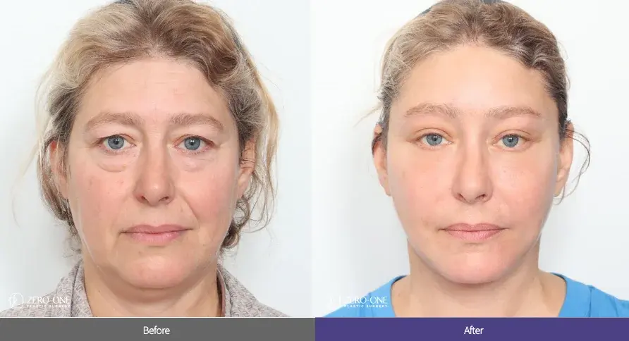 ZERO.ONE Plastic Surgery — 1