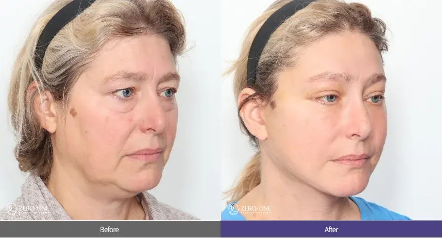 ZERO.ONE Plastic Surgery — 2
