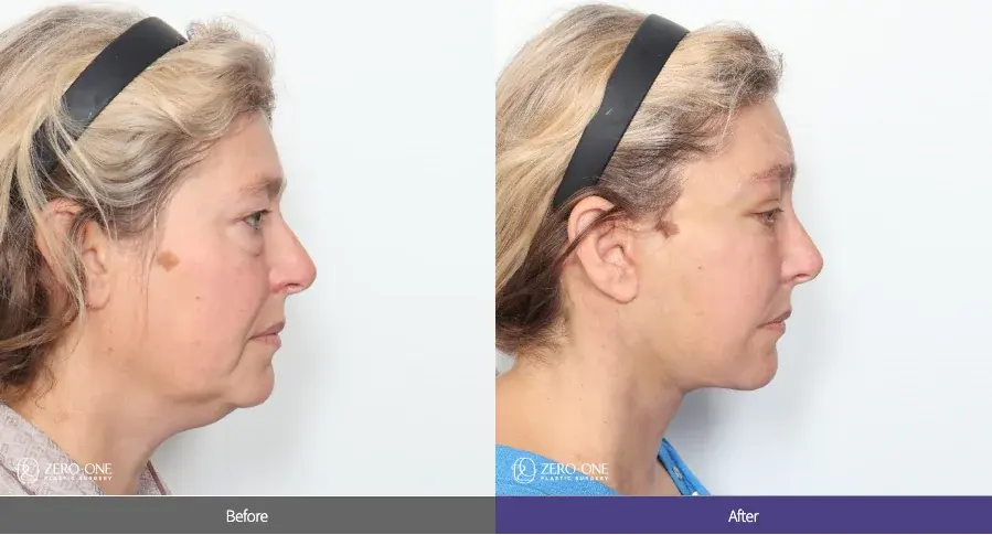 ZERO.ONE Plastic Surgery — 3