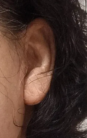 IPCHE Plastic Surgery — 2