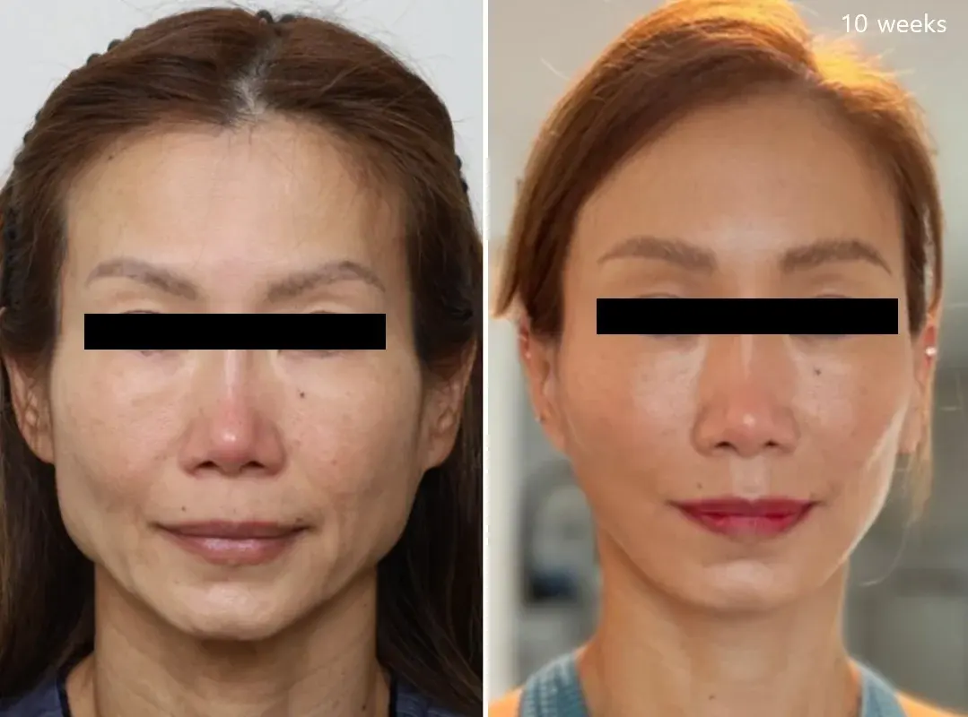 IPCHE Plastic Surgery — 1