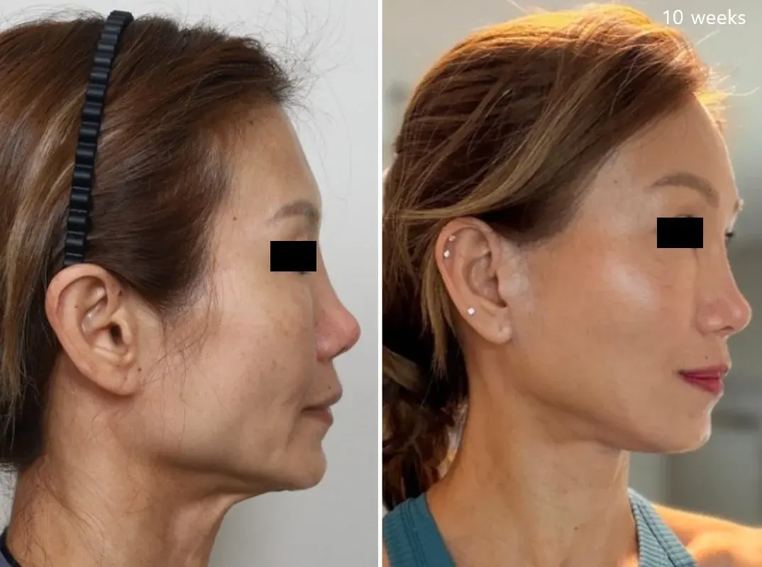 IPCHE Plastic Surgery — 2