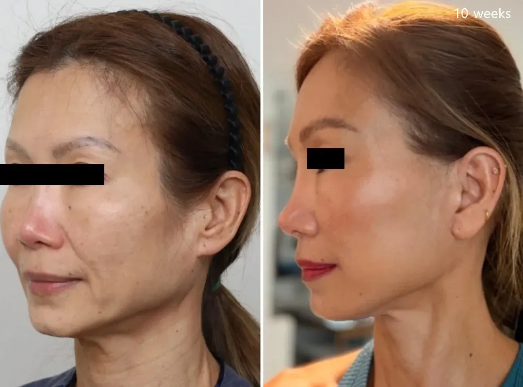 IPCHE Plastic Surgery — 3