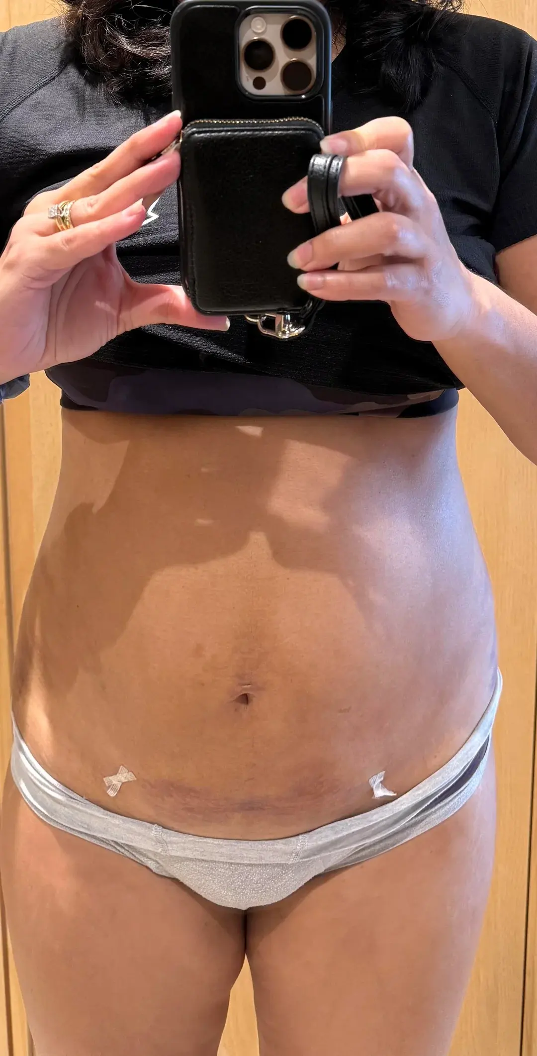 Apgujeong Seoul Plastic Surgery — 5