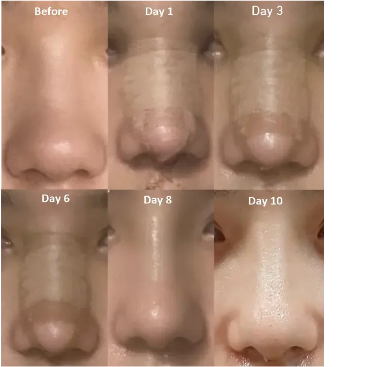 ZERO.ONE Plastic Surgery — 2