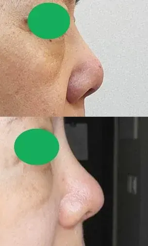 GIRIN Plastic Surgery Clinic — 2