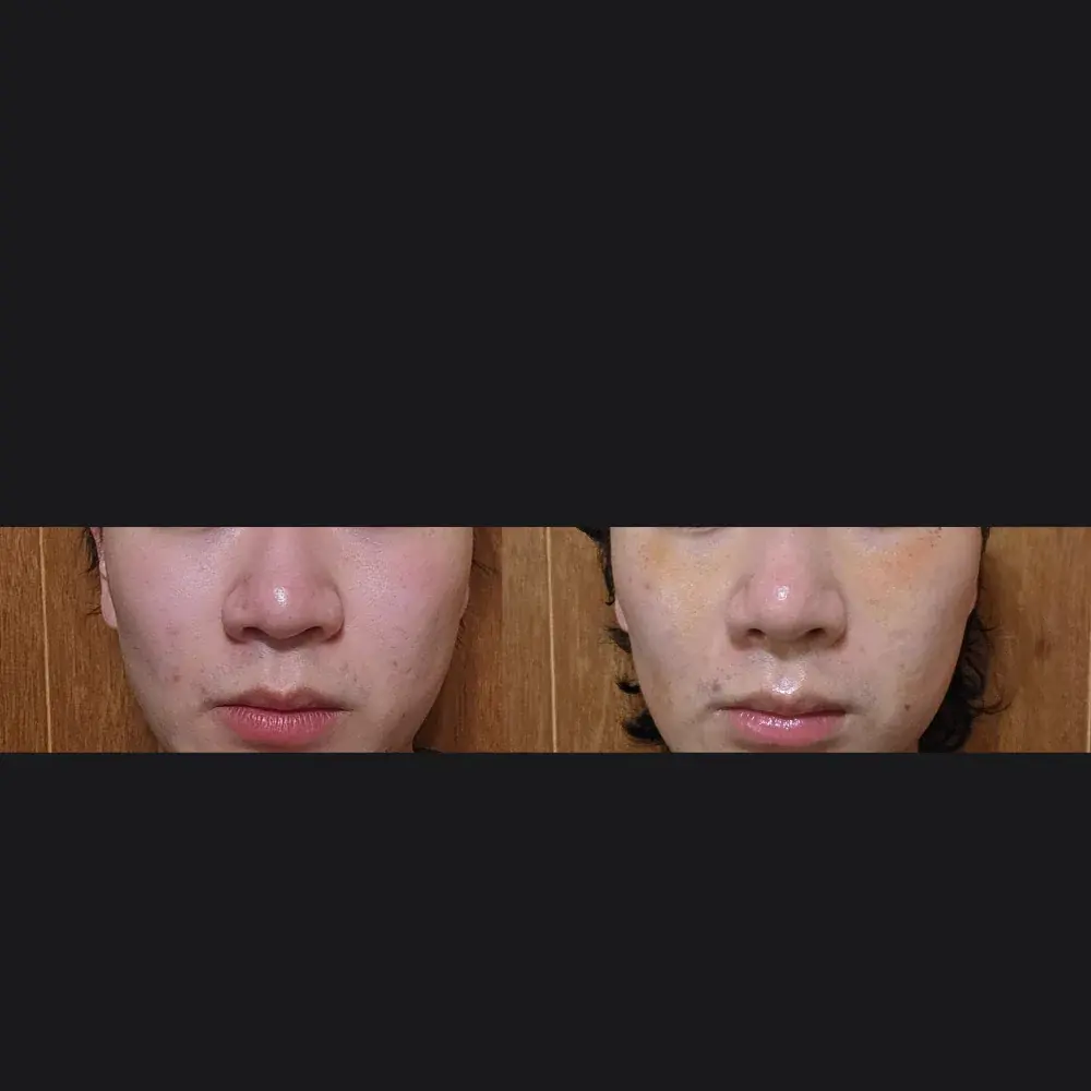 Apgujeong Seoul Plastic Surgery — 1