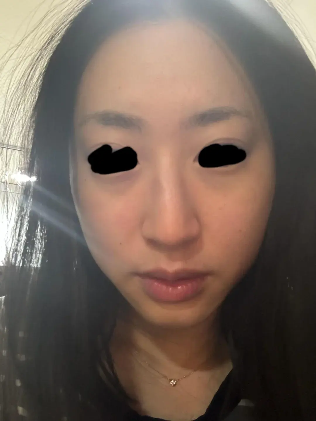 Apgujeong Seoul Plastic Surgery — 1