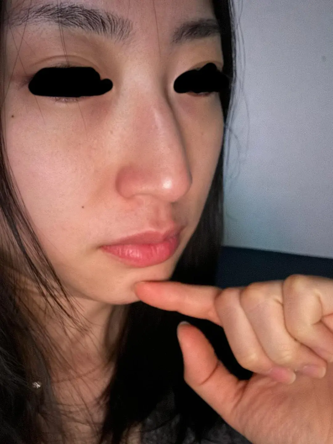 Apgujeong Seoul Plastic Surgery — 2
