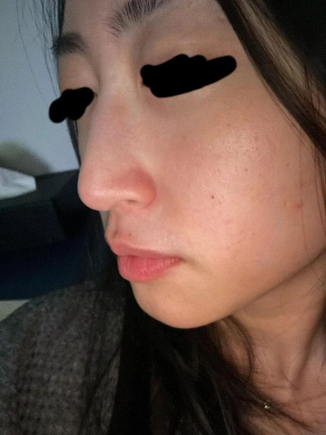 Apgujeong Seoul Plastic Surgery — 3