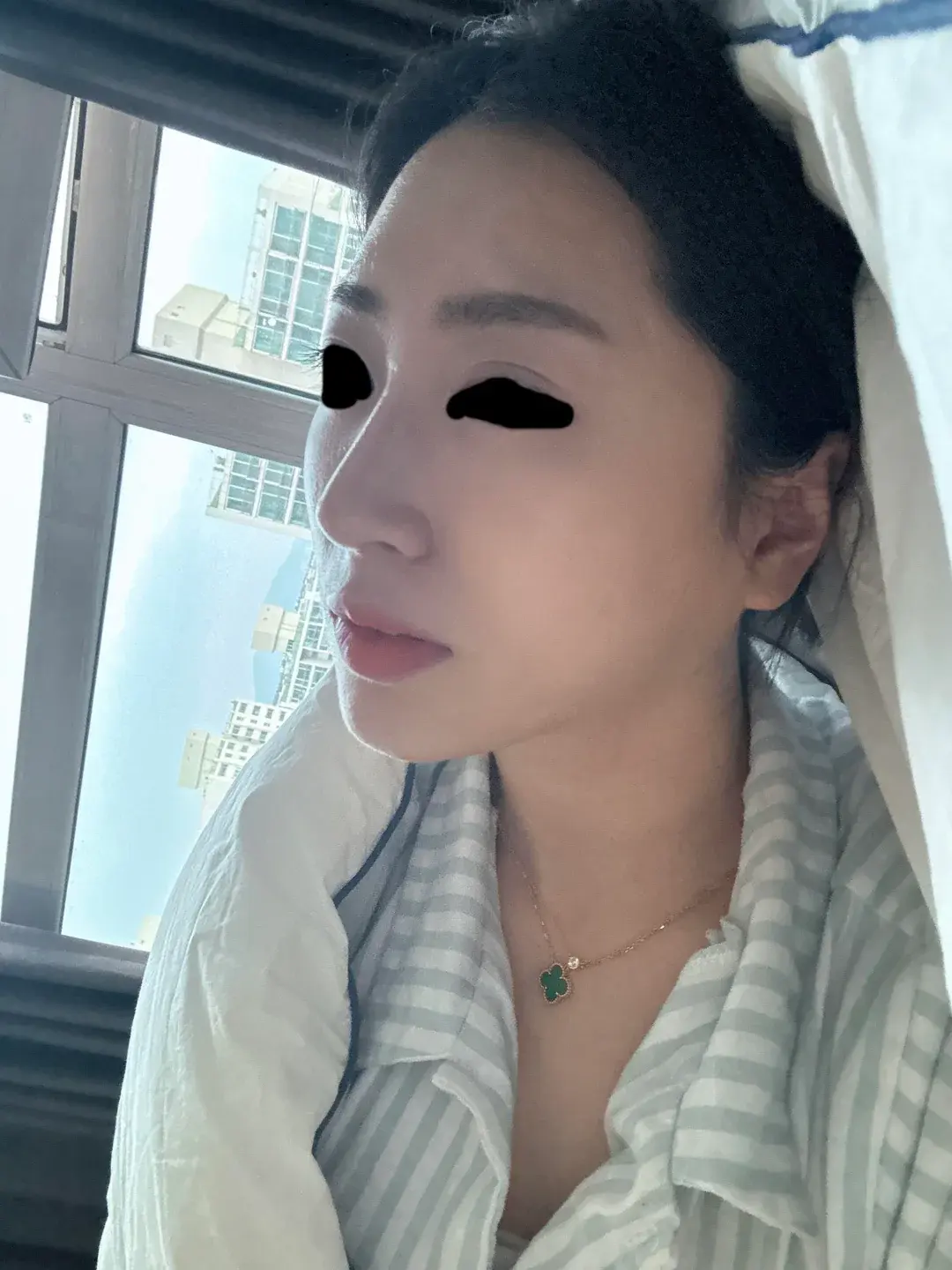 Apgujeong Seoul Plastic Surgery — 5