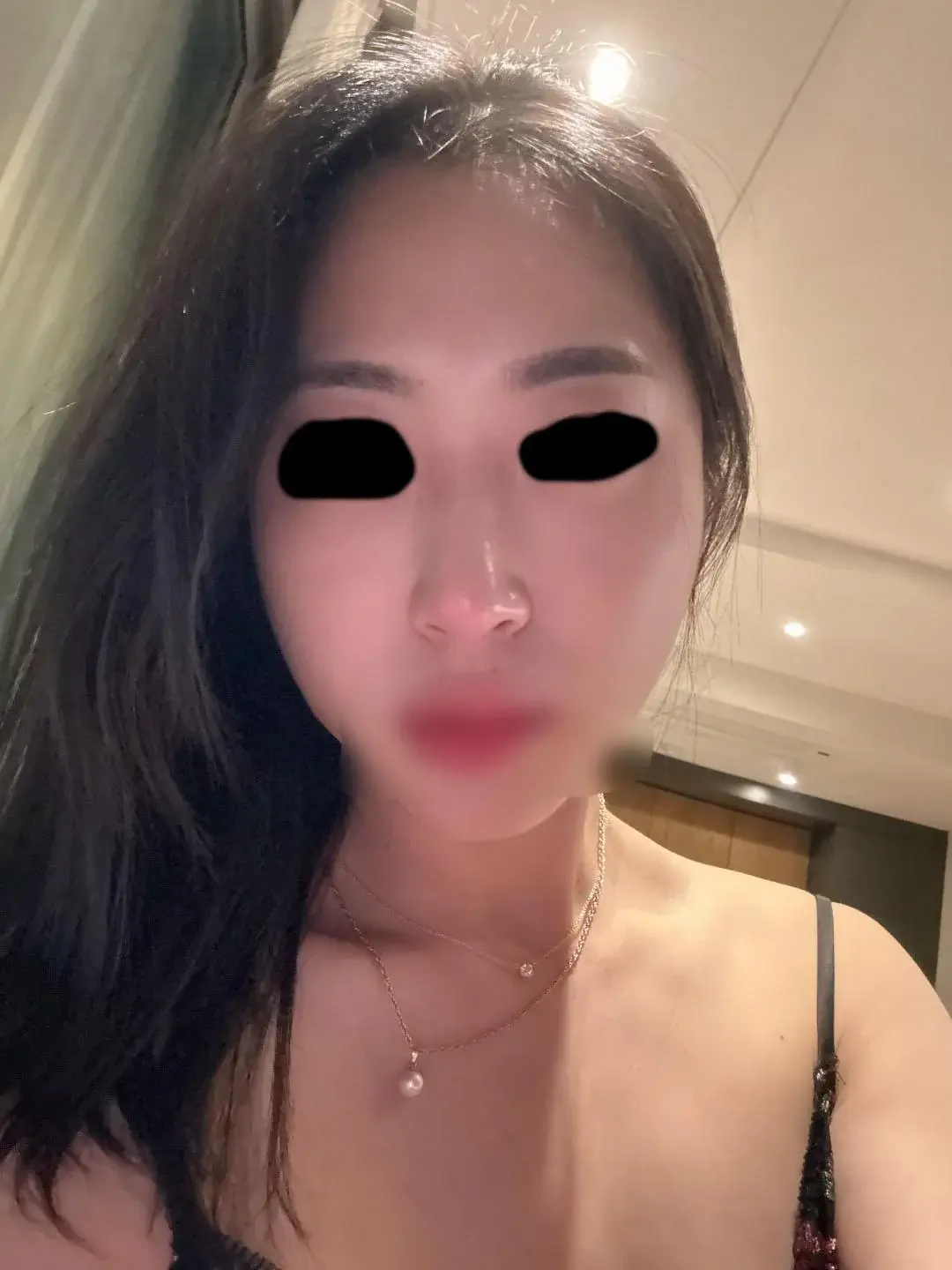 Apgujeong Seoul Plastic Surgery — 7