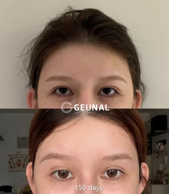 Geunal Plastic Surgery — 1