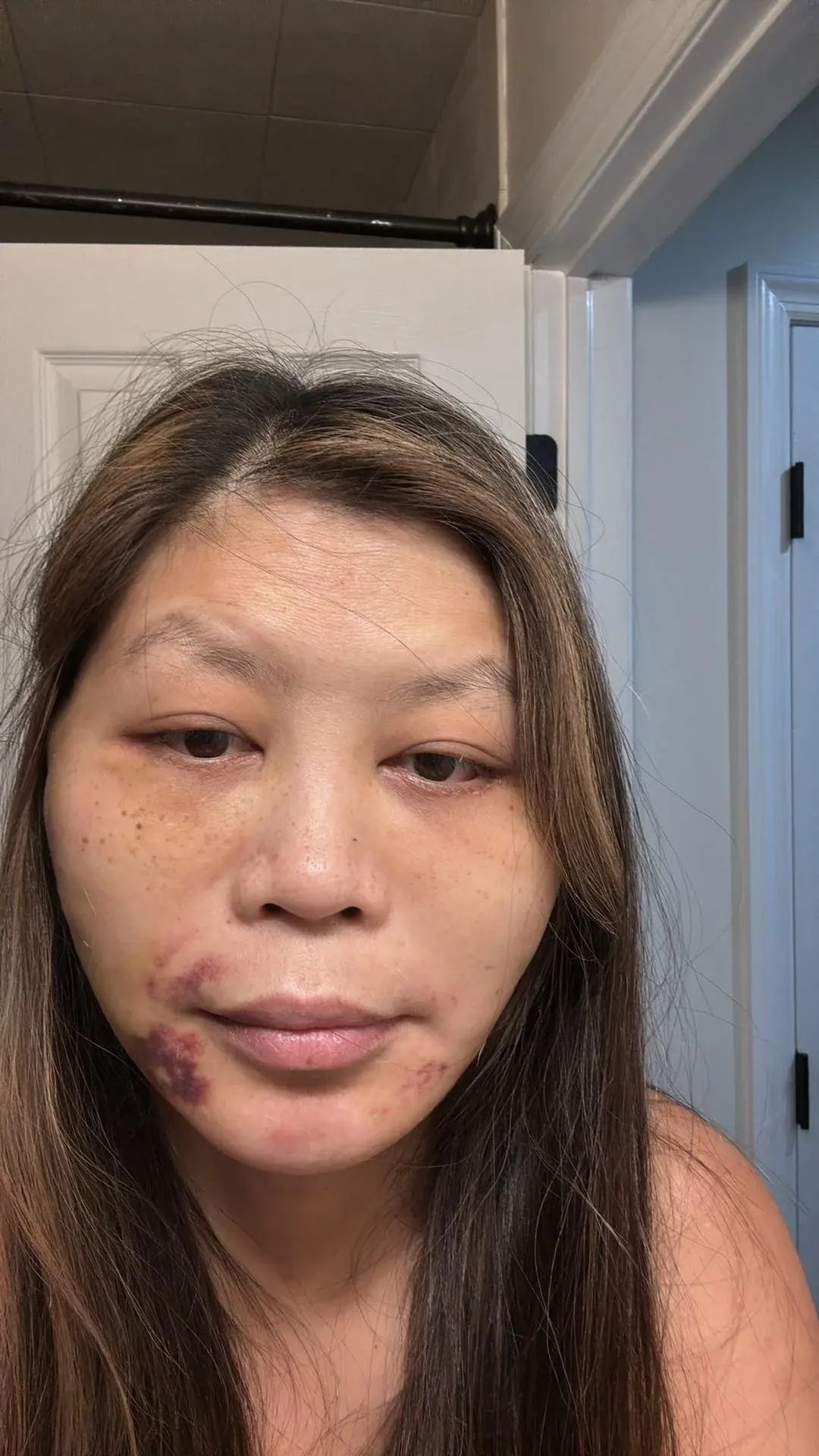 Topface Plastic Surgery — 7