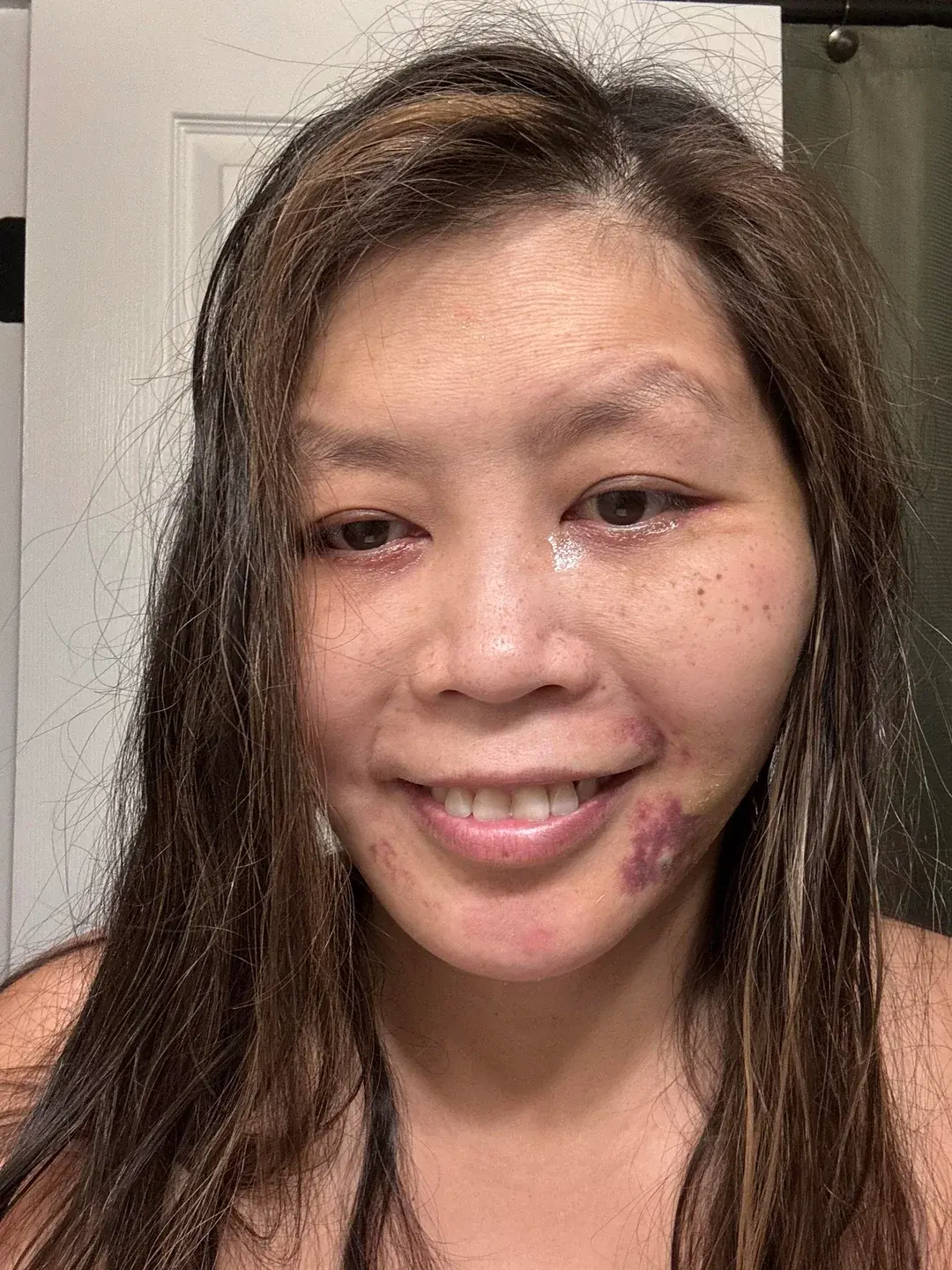 Topface Plastic Surgery — 8