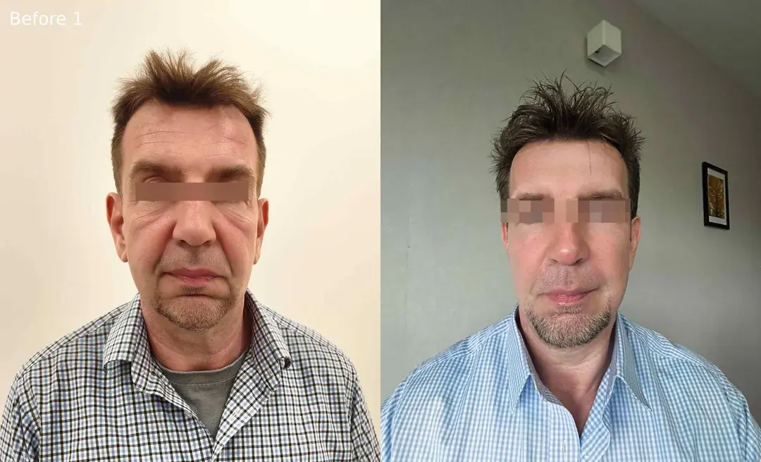 Dasipium Plastic Surgery — 1