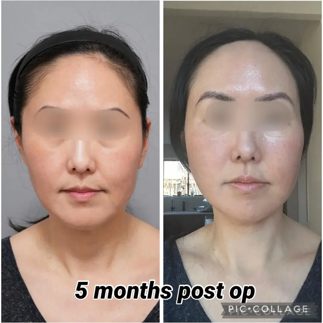 ETONNE Plastic Surgery — 1