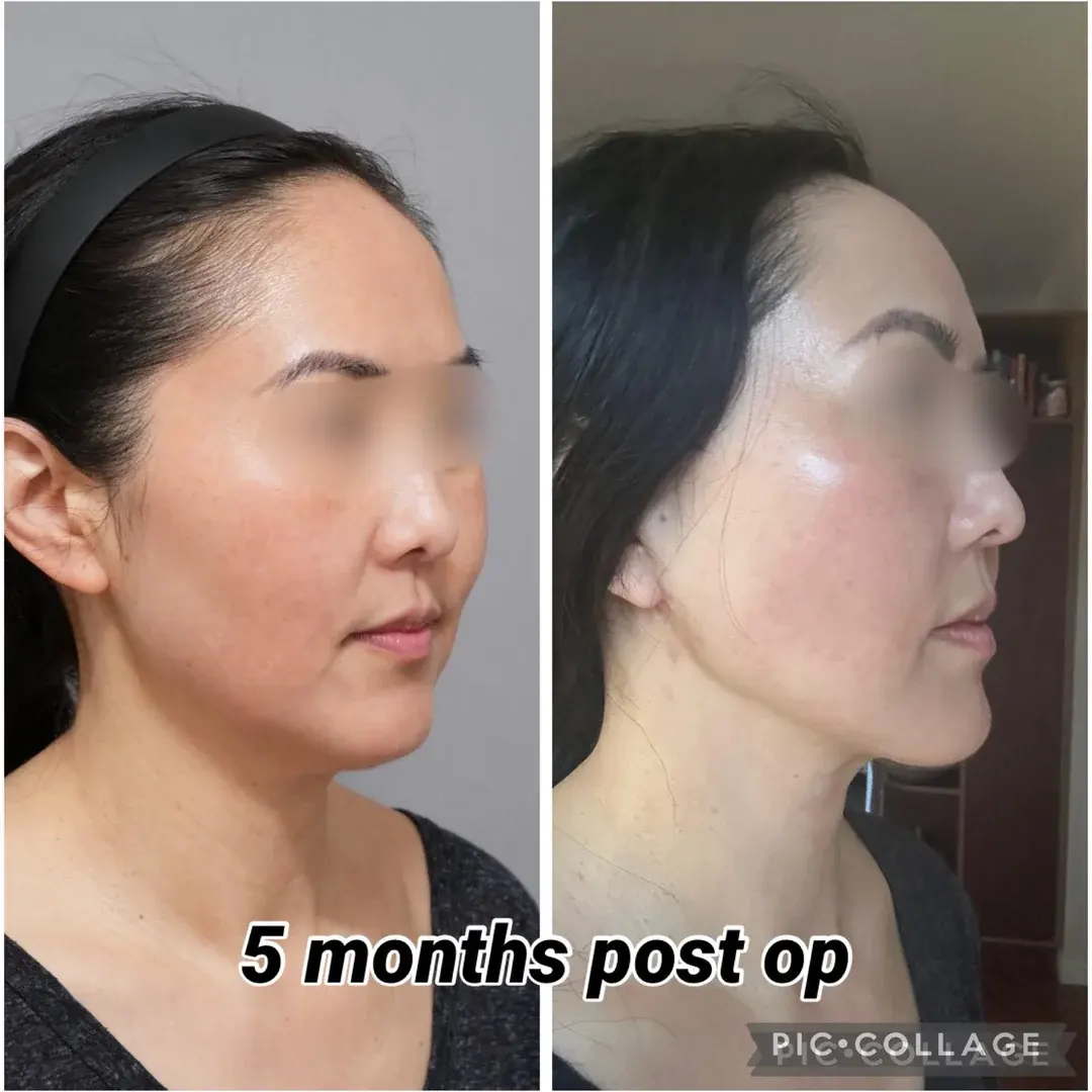ETONNE Plastic Surgery — 2